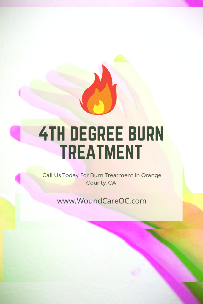 4th degree burn treatment