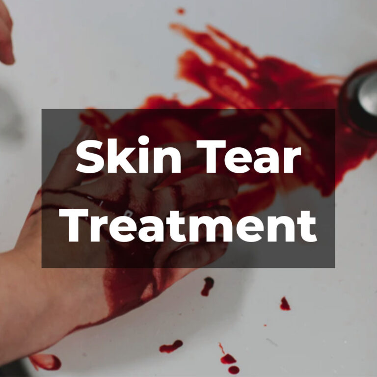 skin tear treatment